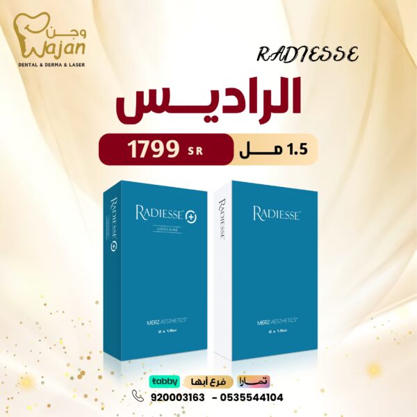 فيلر الراديس