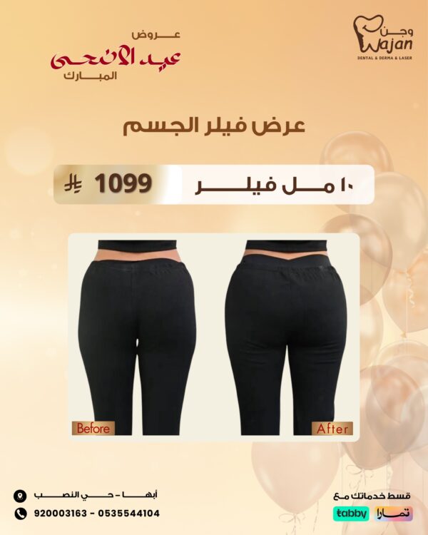 عرض فيلر الجسم